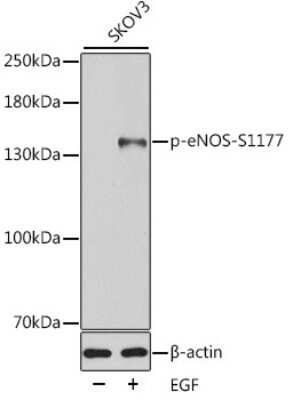 Western Blot: eNOS [p Ser1177] AntibodyAzide and BSA Free [NBP3-05432]